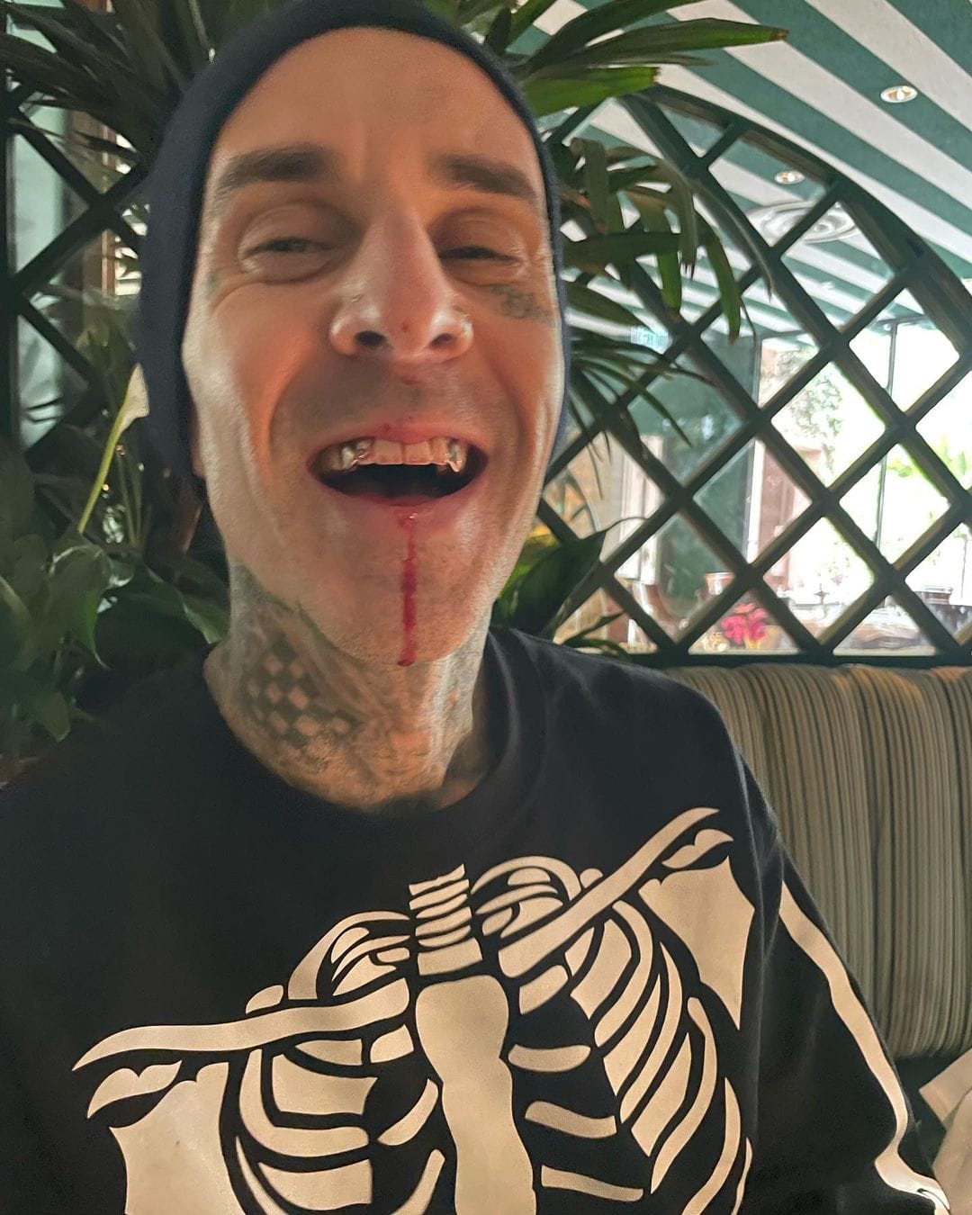Travis Barker Wiki, Age, Height, Girlfriend, Wife, Parents, Ethnicity, Movies, Net Worth, Biography & More 2023 - networth, wiki, biography