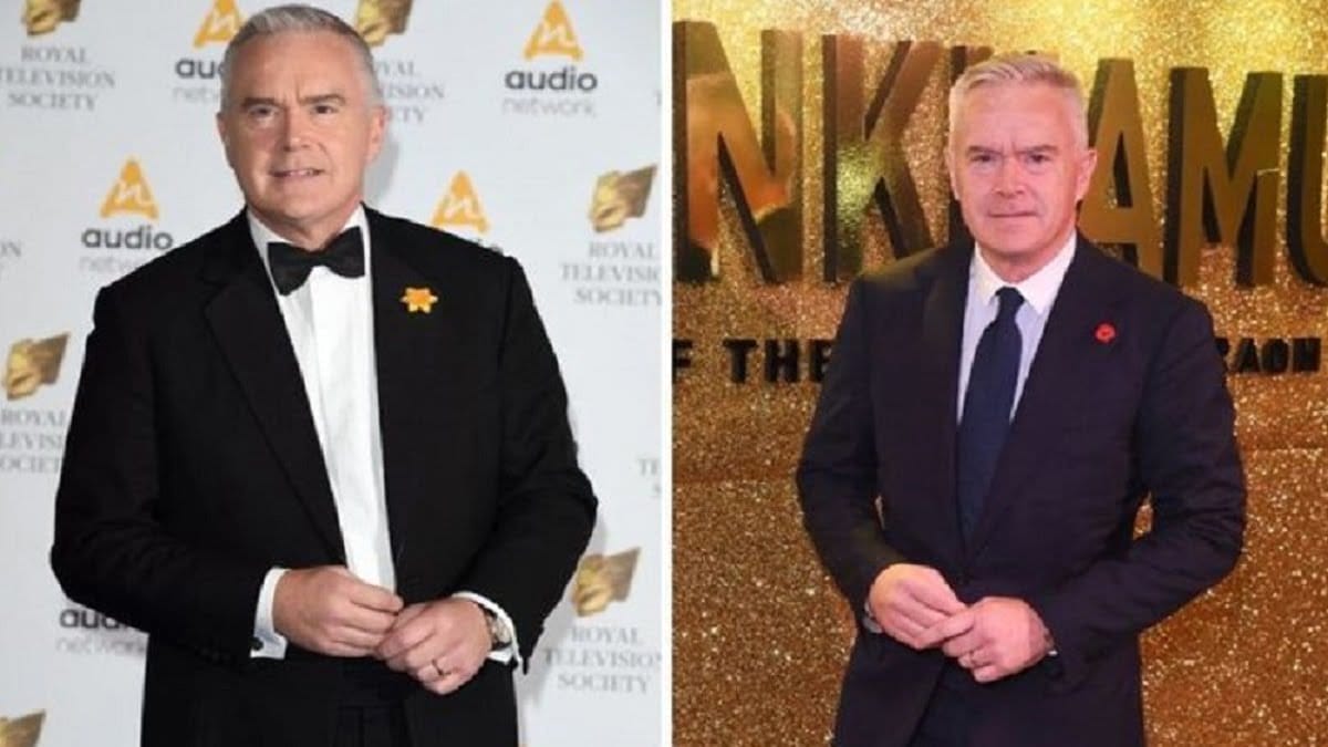 What Is Wrong With Huw Edwards’s Face? Plastic Surgery After And Before 2023 - networth, wiki, biography